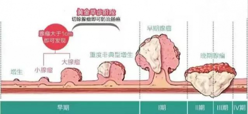 沈阳中泰肛肠医院 ▏胃肠息肉是怎么长出来的？有什么危害？