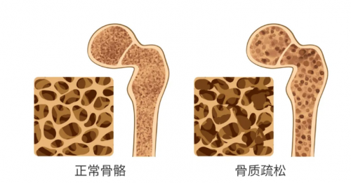 长轻营养食疗提醒您：这种牛奶很伤肝，别当早餐了！