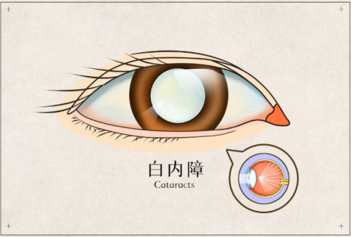 郑州视献眼科医院——眼睛居然也要防晒？-热点健康网