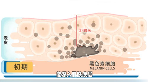 露卡菲娅祛斑套装祛斑效果怎么样？深度祛斑，让肌肤焕发出自信的光芒