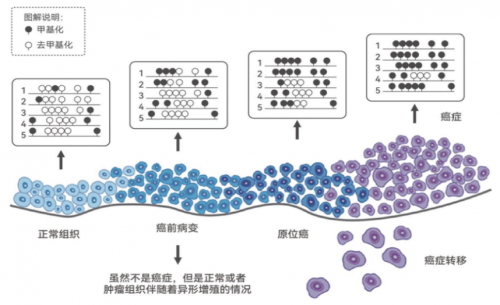 筑牢健康防线，华大基因基因检测技术助力宫颈癌早筛-热点健康网