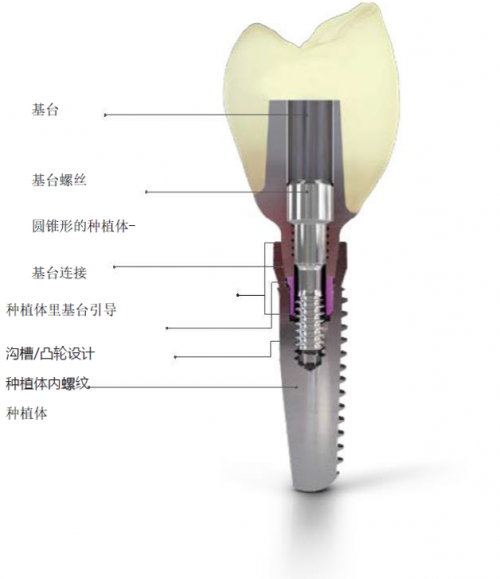 牙冠VS种植牙，谁的修复效果更好？Camlog科美勒告诉您答案