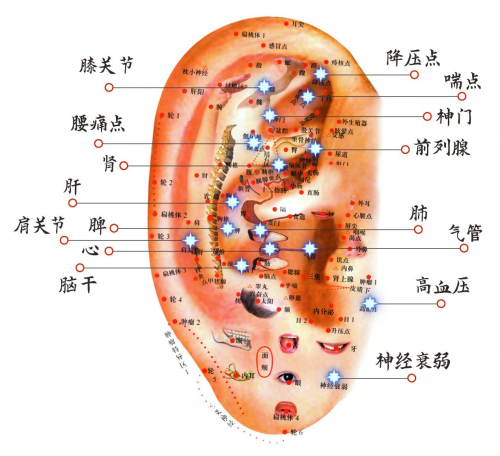 華漢針神耳穴全息療法開啟神經(jīng)衰弱治療新篇