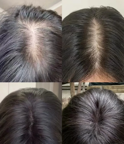 消费者口碑认证传播，畅销前十育发液什么牌子最有效果？国产优异