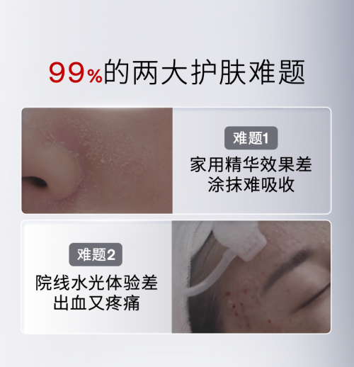 “在家打水光，无痛又专业“，Jmoon极萌推出全新家用水光美容仪