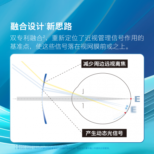 蔡司成长怡镜片临床试验传捷报，6个月效果显著