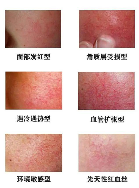 敏感肌护肤总做无效功？东方佰丽修颜瓶协助破解“吸收困局”