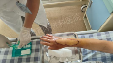 跨越千里的信任！顺德和平外科医院成功治愈福建患者复杂创伤