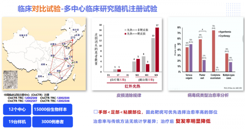 特定波光能免疫诱导疗法：HPV感染治疗新选择