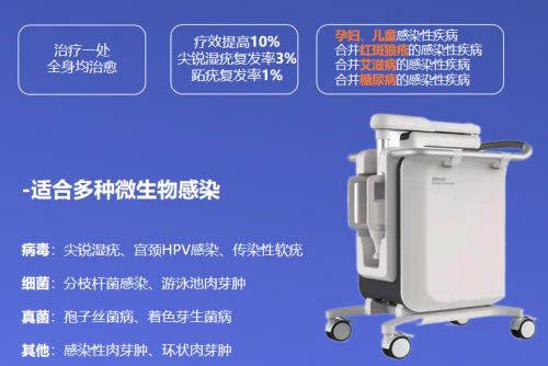 特定波光能免疫诱导疗法：HPV感染治疗新选择