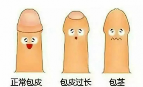 龙马潭区妇幼保健院包皮环切术！放下“包”袱，绽放青春精彩！(图3)