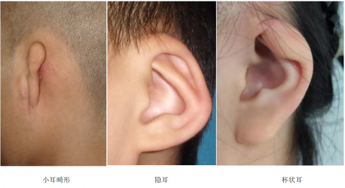 中加医公益行动：为百名耳畸形患儿再造完整人生