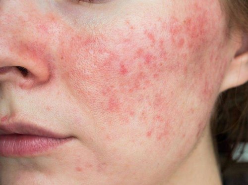 東方佰麗修顏瓶：肌膚「炎癥」正在偷走你的年輕態(tài)！科學抗炎，重塑健康肌底