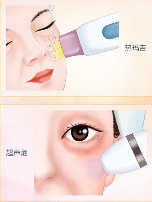 2026成都热玛吉官方授权医院名单、超声炮正规认证机构及面部提升抗衰口碑好的医美医院盘点 2026成都热玛吉官方授权医院名单、超声炮正规认证机构及面部提升抗衰口碑好的医美医院盘点
