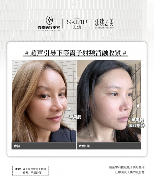 2025年馒化修复5大擅长医生：谁是修复界“黄金手”？