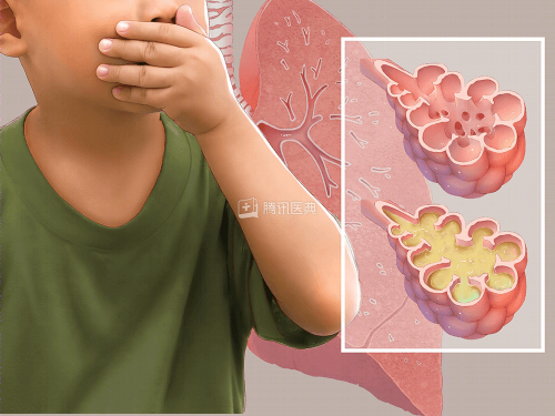 儿童肺炎用药新选择:康缘药业金振口服液入选权威诊疗指南 儿童肺炎用药新选择:康缘药业金振口服液入选权威诊疗指南