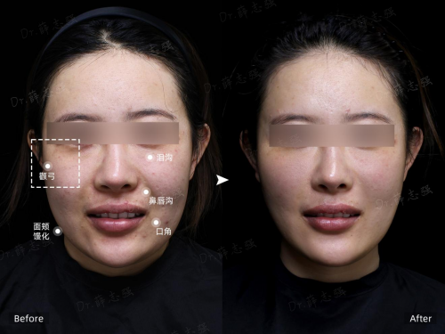 2025年馒化修复找哪家医美机构？解锁俊泰美好医疗