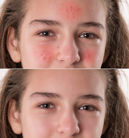 静愈时光，以细胞级修护唤醒肌肤本源|东方佰丽修颜瓶，重塑抗炎护肤哲学