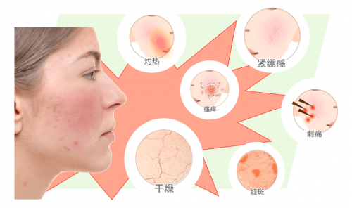 东方佰丽PDRN的分子机制与应用：秋季敏感肌肤修复的科学解析