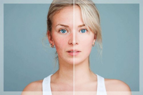 换季就泛红刺痛？艳存晓年轻胶原水光为敏感肌“灭火”