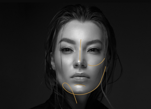 安珍适®VL琼脂糖：法令纹无痕填充，解锁原生自然美感