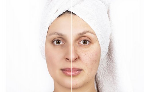 艷存曉年輕膠原水光：黃氣克星！膠原養出的通透亮澤臉