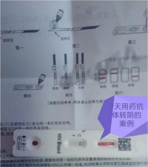 命急丸世界唯一;HIV七天有抗体转阴