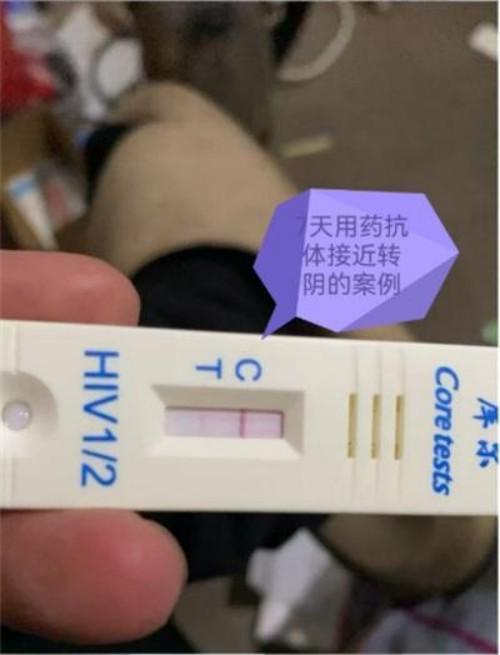 命急丸世界唯一;HIV七天有抗体转阴