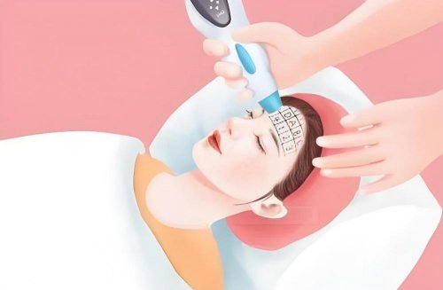 破解光電術(shù)后修復(fù)難題:艷存曉年輕膠原水光套組,長效抗衰新篇章