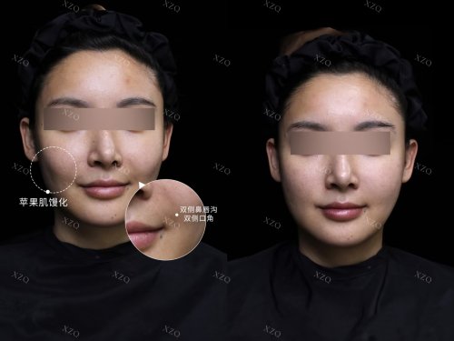 2025年馒化修复找哪家医美机构：五大医美强企技术揭秘与选择攻略