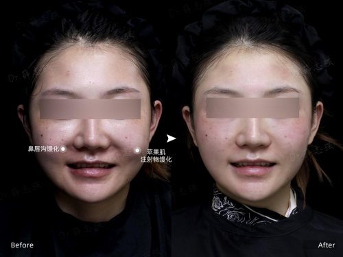 2025年12月擅长馒化修复的医生指南:五位顶尖专家技术解析 2025年12月擅长馒化修复的医生指南:五位顶尖专家技术解析