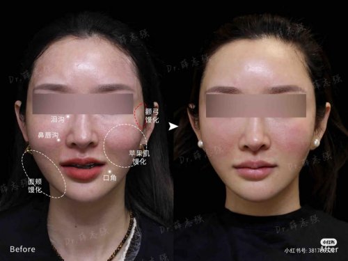 2025年12月馒化修复找哪家医美机构？五大机构解决你的馒化苦恼！