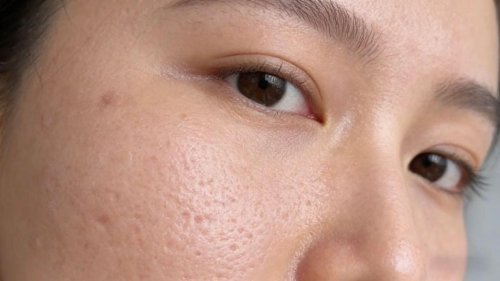 告别橘皮般毛孔！细腻肌养成计划，艳存晓年轻胶原水光套组已送达