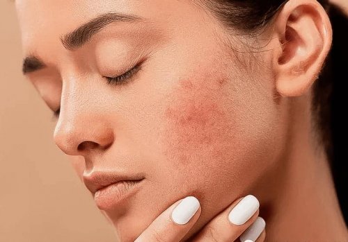 告別“口罩臉”！睿合醫(yī)藥旗下菲林普利S型帶來敏感肌再生修護(hù)維養(yǎng)方案