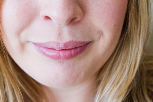 时光逆袭战，菲林普利M型如何让法令纹“举手投降”？