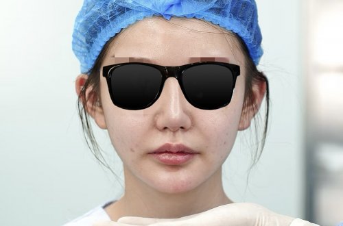 注射圈秘密流出：大佬悄悄换‘牌’了？安珍适®VL琼脂糖让咱从此告别馒化？