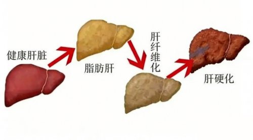 皮肤暗黄，口臭频发，容易疲惫，失眠，你的肝还健康吗？