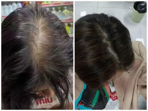 2025效果最好的良心国货防脱洗发水！防脱洗发水排行榜前十名