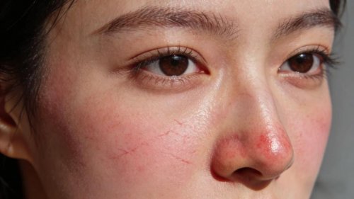 修护屏障，终结敏感循环：艳存晓年轻胶原水光套组重塑健康肌底