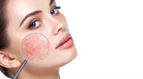 敏感肌的“鎮(zhèn)定劑”｜告別“臉紅焦慮”，艷存膠原水光以“修”代“遮”