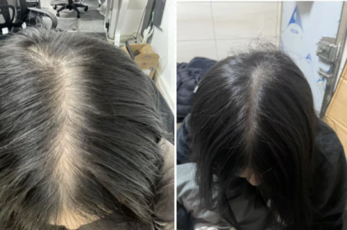 2026防脱发生发增发密发哪个牌子效果好?秋冬十大满分育发产品排行榜评测,超值 2026防脱发生发增发密发哪个牌子效果好?秋冬十大满分育发产品排行榜评测,超值