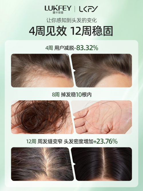 锋芒尽显!露卡菲娅防脱洗发水摘得中国好配方年度防脱大奖,以国妆特字打破发缝稀疏困境 锋芒尽显!露卡菲娅防脱洗发水摘得中国好配方年度防脱大奖,以国妆特字打破发缝稀疏困境