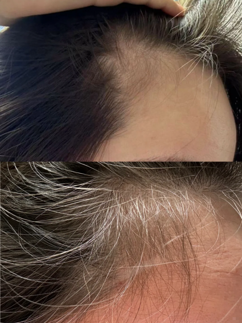 脱发多维解析！2026生发液什么牌子最有效果？先防脱再密发，防脱产品排行榜前十值得买