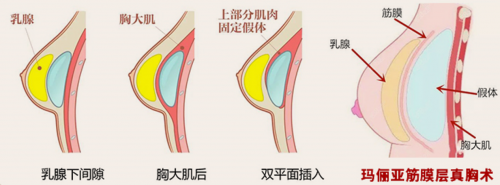 体系化实力铸就品质丰碑，中家医荣膺2025年度“美胸品质机构”