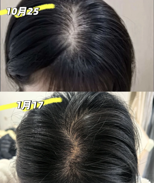 防脱育发液哪个品牌效果好？领域十大优质防脱生发品牌对比，露卡菲娅科技赋能防脱