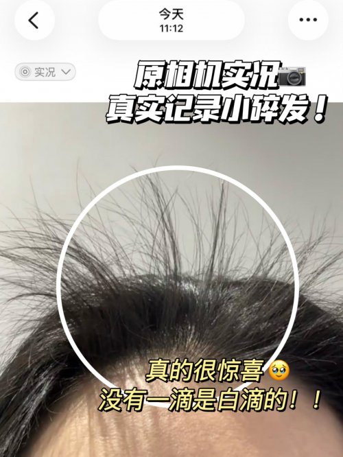 防脱育发液哪个品牌好？2026防脱产品前十实测曝光，30天掉发减40％