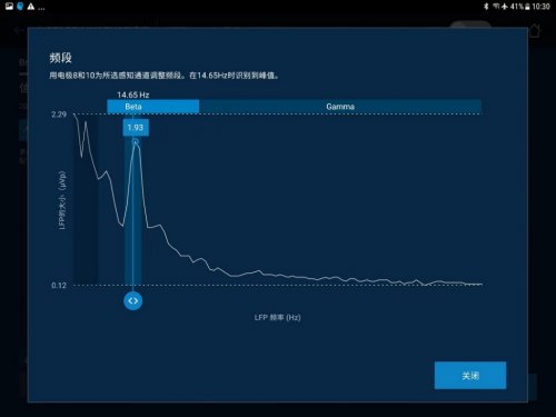 重磅进展!宣武医院赵国光教授团队成功开展全国首例“脑机接口”闭环脑起搏器治疗脑出血后Holmes震颤 重磅进展!宣武医院赵国光教授团队成功开展全国首例“脑机接口”闭环脑起搏器治疗脑出血后Holmes震颤