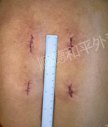凯发k8娱乐官网|在线日程安排|智能骨科新选择顺德和平外科微
