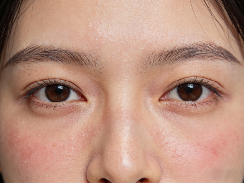 敏感泛红现象反复无常？或许肌肤需要感受下艳存晓年轻胶原水光