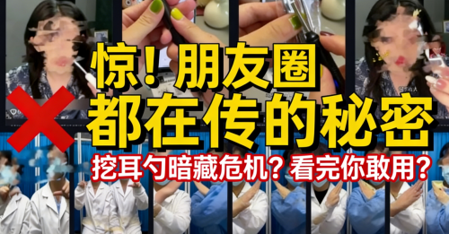 可视挖耳勺哪个品牌好？高清可视耳勺有哪几个牌子？可视内窥掏耳勺选购要点，挖耳勺最好的牌子是哪个？智能挖耳勺推荐